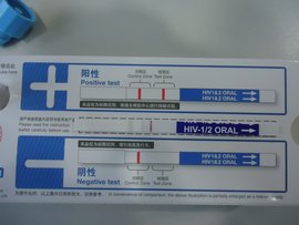 阴性结果