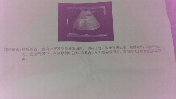 月经量少,时间不定差几天,痛经,月经来。之前去